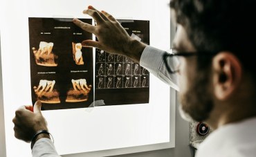 APHTES ET PETITES PLAIES DANS LA BOUCHE : Comment calmer la douleur et cicatriser ?